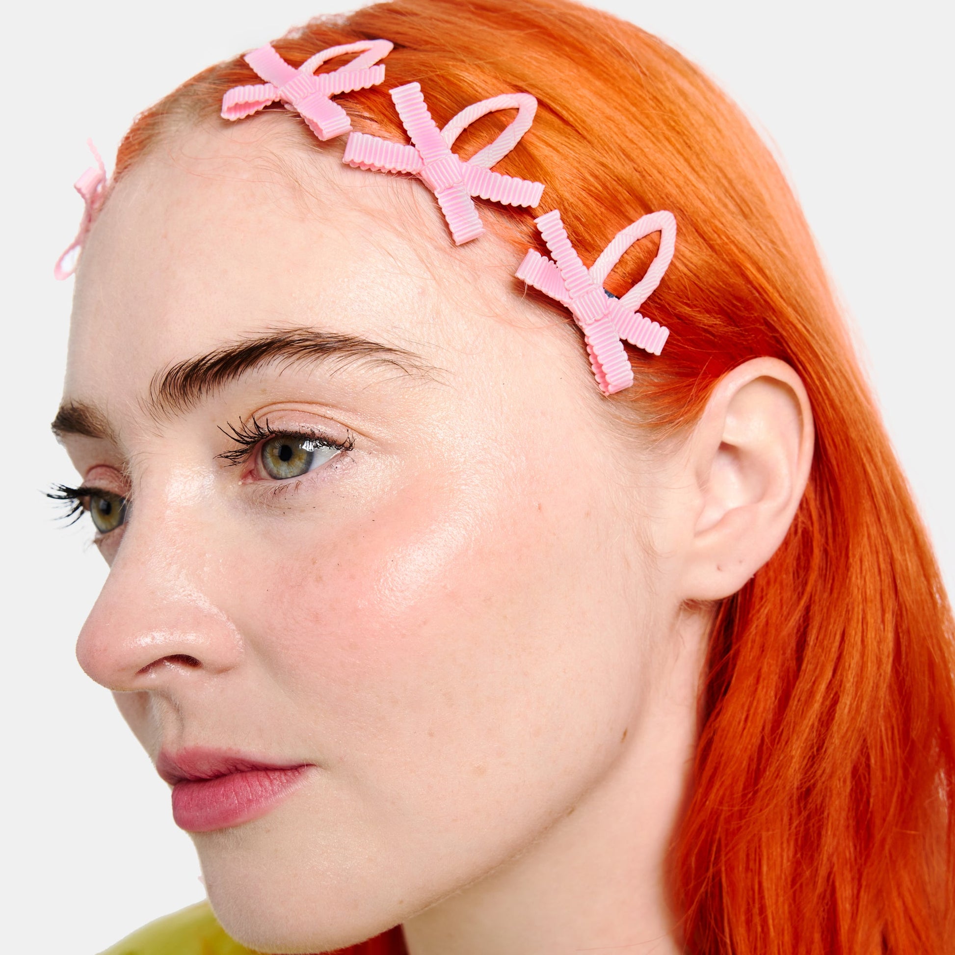 Woman with short orange hair wearing multiple light pink bow snap clips.